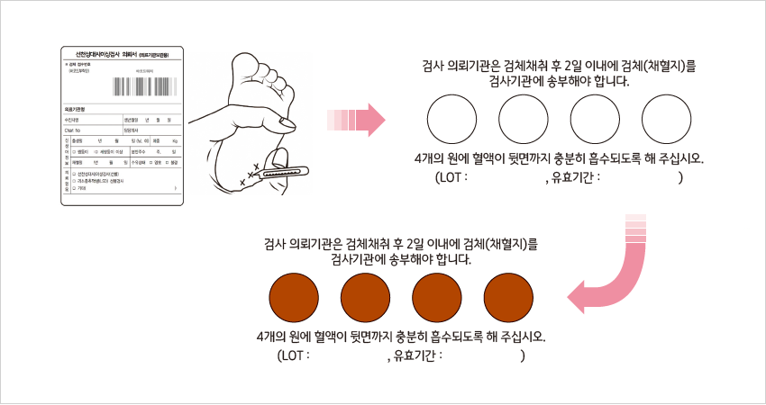 산전태아검사